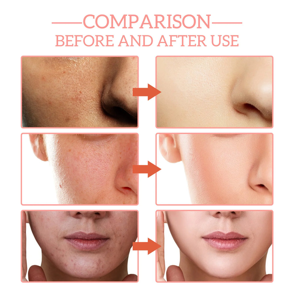 5 In 1 Fade fine lines Firming Face Serum Blemish Pigmentation Reducing Beauty Serum Removal Moisturising Skin Firming Blemish